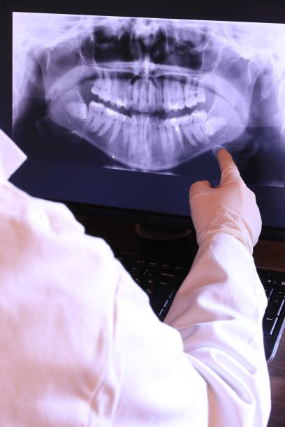 Best Emergency Root Canal Treatment in Northlake, TX